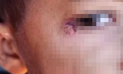 Öğrencinin yüzünde sigara söndüren temizlik görevlisi tutuklandı