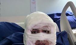 İstanbul'da dehşet: Kadın kadını yaktı!