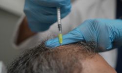 Saç dökülmesi vücudun alarmı olabilir