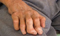 Cüzzam Avrupa'ya geri döndü!