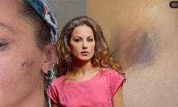 Yıldız Asyalı’dan şoke eden itiraf: "Eşim tarafından darp edildim"