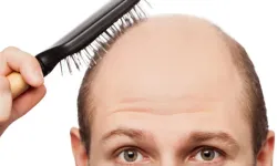 Kellik tarihe mi karışıyor? Devrim niteliğinde ilaç geliştirildi