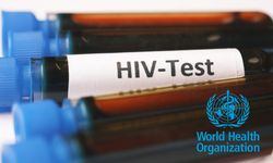 DSÖ, AIDS vakalarını açıkladı: Sayılar endişe verici