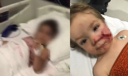 Pitbull, iki çocuğa dehşeti yaşatmıştı! Baba isyan etti: 12 kez şikayet edildi...