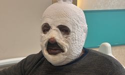 Kalorifer kazanını yakmak isterken canından oluyordu: Ben yandım kimse yanmasın