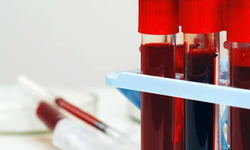 Kanınızda gizli hastalık olabilir! İşte en riskli kan grubu