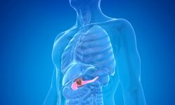 İspanya’da pankreas kanserine umut veren çalışma