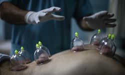 Hacamat Nedir? Geleneksel tıbbın modern yansıması