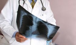 Zatürre (pnömoni) nedir, belirtileri nelerdir? İyileşme süreci nasıl olur?