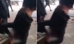 Zihinsel engelli genci ayağından vince astılar! 4 kişi gözaltına alındı