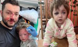 Yalova'da komşuların gürültü kavgasında 14 aylık bebek hastanelik oldu