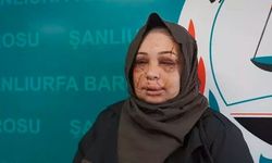 Eşinin yüzünü parçalamıştı: Polis memuru hakkında görevsizlik kararı