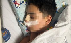 Antalya'da "neden bakıyorsun?" kavgası: 15 yaşındaki gencin burnunu kırdılar