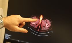 Dünyada sadece 60 kişide görülen hastalık Diyarbakır'da