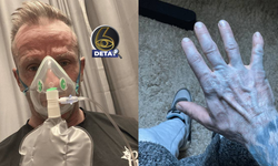 Teni maviye dönenen adamın sırrı çözüldü