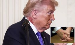 Trump'ın boynundaki gizemli lekenin sırrı çözüldü