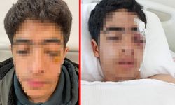 Akran zorbalığı felaketi getirdi: "Şaka yapma" diyen çocuğu muştayla öldüresiye dövdüler!