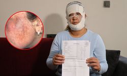 Güzelleşmek isterken faciayı yaşadı: Çocuğum beni görünce "öcü" diyerek kaçtı!