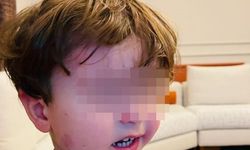 Kreşte darp iddiası: Savcılık inceleme başlattı