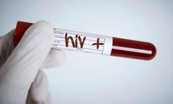Dikkat! Türkiye'de HIV vakalarında artış başladı!