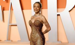 Doja Cat’ten sağlık itirafı: "Selülit sandığım şey lipödem çıktı"