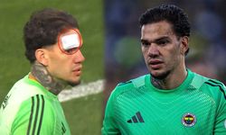 Ederson’a yabancı madde isabet etti!