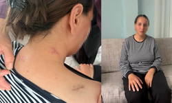 Mersin'de mucize kurtuluş! Cani kocanın 17 bıçak darbesine rağmen hayatta kaldı: Beni öldü zannetti