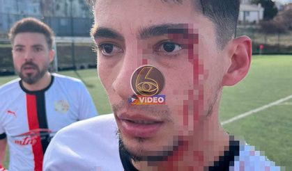 Sahanın ortası savaş alanına döndü: 3 futbolcu hastanelik oldu I VİDEO