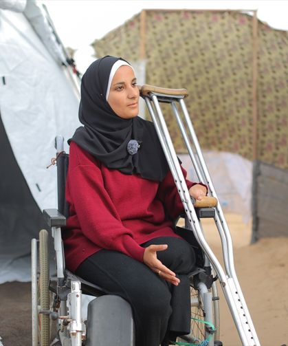 Gazze'de yarım kalan bir hayat! Bacağını kaybetti, çadıra mahkum oldu