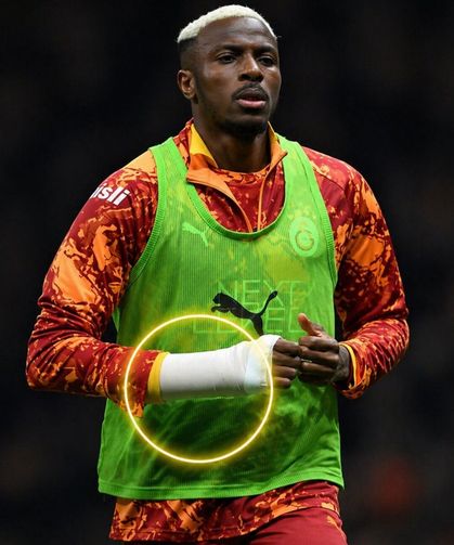 Osimhen’in kolundaki koruyucuyla sahaya çıkacak mı?