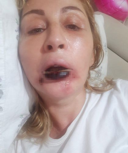Estetik operasyon sonrası hayatı değişti: 7 yıldır mahkeme kapılarında