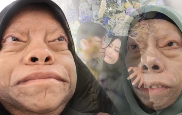 Tiktok 'kertenkele suratlı' ailenin hayatını değiştirdi! Kimse onlara yaklaşmazken gerçek aşkı bakın nasıl buldu!