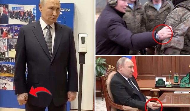 Putin'in sağ elindeki şişlik tartışma yarattı: Hasta mı?