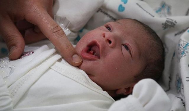 Yenidoğan bebek dişli doğabilir: Uzmanlardan ailelere önemli uyarılar