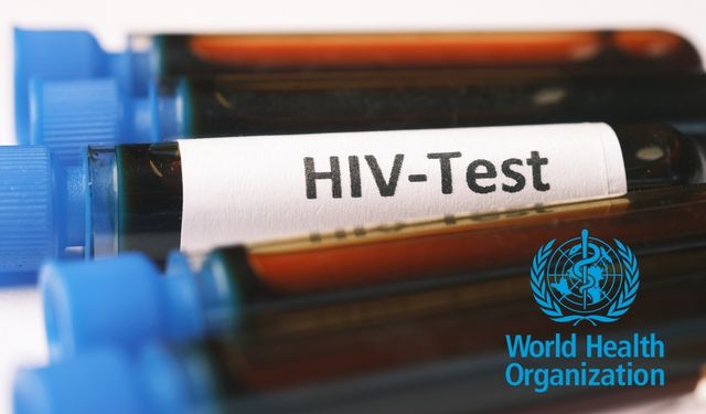 DSÖ, AIDS vakalarını açıkladı: Sayılar endişe verici