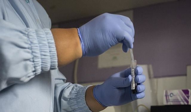 HIV alarmı: Dünyada azalırken neden Türkiye'de artıyor?