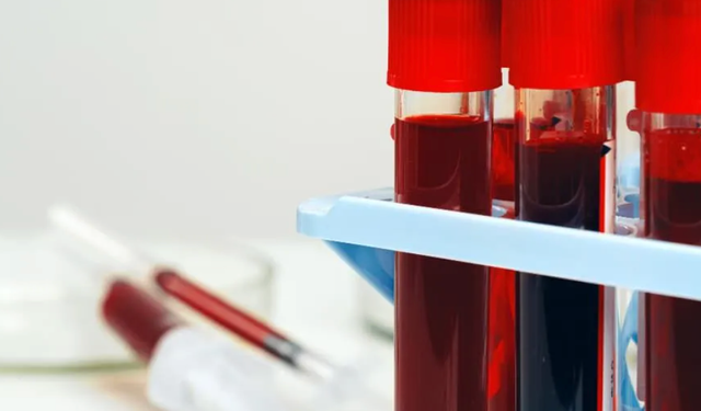 Kanınızda gizli hastalık olabilir! İşte en riskli kan grubu