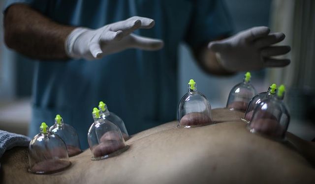 Hacamat Nedir? Geleneksel tıbbın modern yansıması