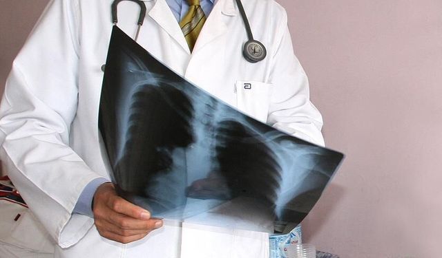 Zatürre (pnömoni) nedir, belirtileri nelerdir? İyileşme süreci nasıl olur?