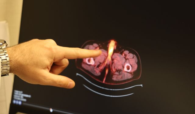 Dünyada sadece 60 kişide görülen hastalık Diyarbakır'da