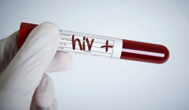 Dikkat! Türkiye'de HIV vakalarında artış başladı!