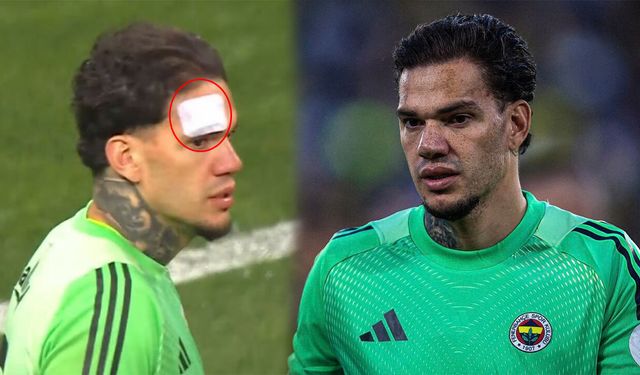 Ederson’a yabancı madde isabet etti!