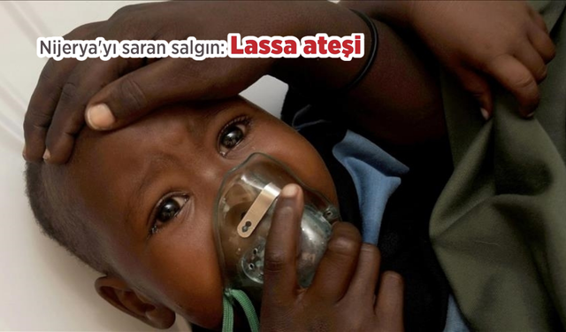 Lassa ateşi Türkiye'ye geldi mi? Lassa ateşi belirtileri nelerdir ve nasıl bulaşır? Nijerya'da can kaybı artıyor!