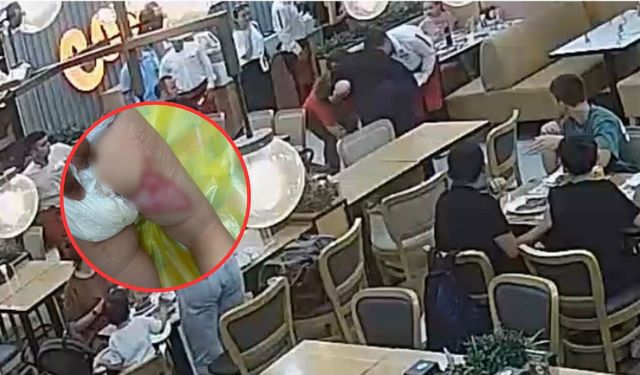 Restorandaki şov faciayla bitti! Yemek kâbusa dönüştü