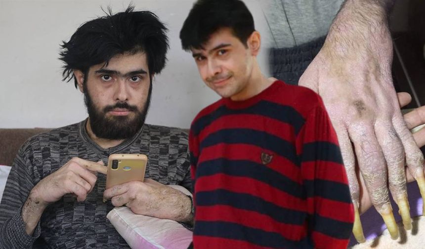 Tüm Türkiye'nin konuştuğu Barış Özbay'ın son hali şaşkına çevirdi