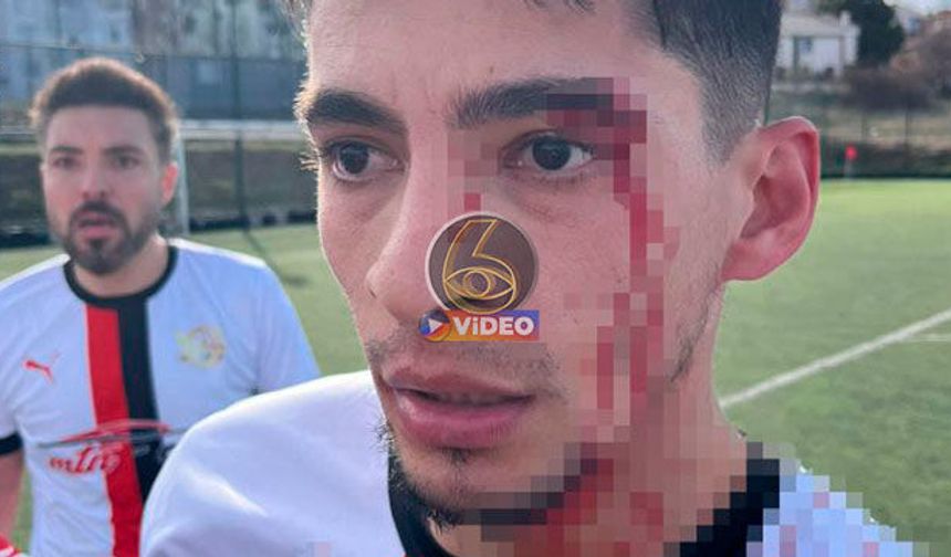 Sahanın ortası savaş alanına döndü: 3 futbolcu hastanelik oldu I VİDEO