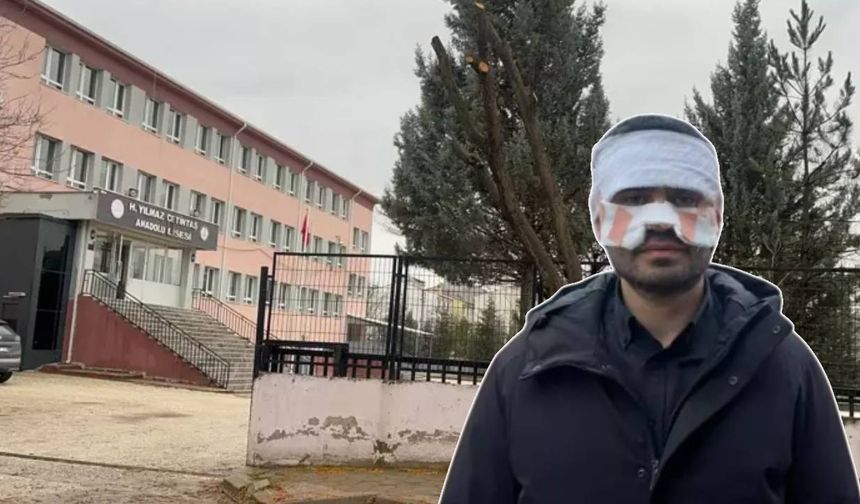 Eskişehir'de öğretmen vahşeti! Meslektaşının yüzünü yaktı