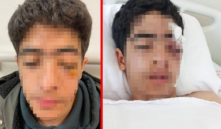 Akran zorbalığı felaketi getirdi: "Şaka yapma" diyen çocuğu muştayla öldüresiye dövdüler!