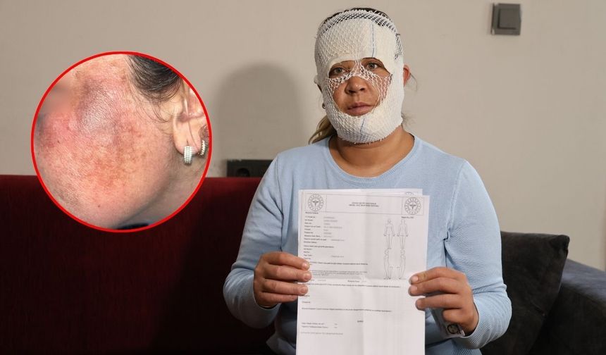 Güzelleşmek isterken faciayı yaşadı: Çocuğum beni görünce "öcü" diyerek kaçtı!