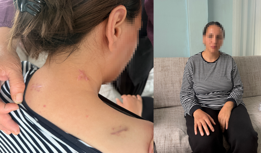 Cani kocanın 17 bıçak darbesine rağmen hayatta kaldı! "Beni öldü zannetti"